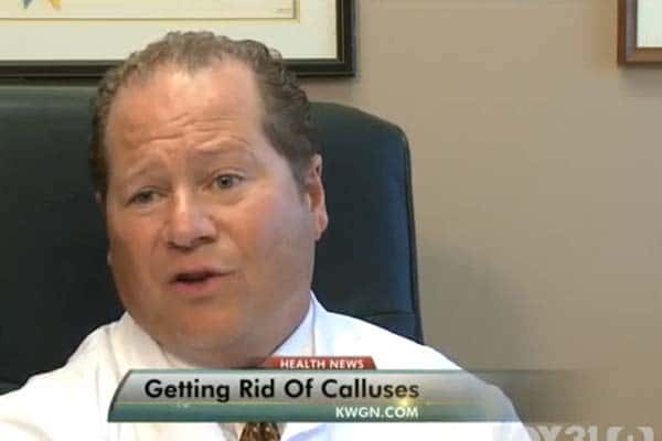 get rid of calluses